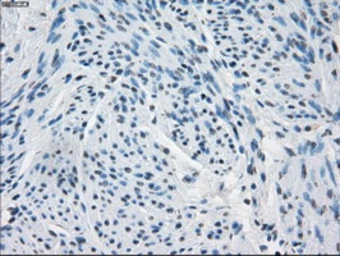Anti-Fumarate hydratase antibody [9G4] used in IHC (Paraffin sections) (IHC-P). GTX84498