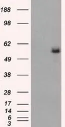 Anti-Fumarate hydratase antibody [9G4] used in Western Blot (WB). GTX84498