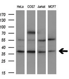 Anti-FGF2 antibody [3D9] used in Western Blot (WB). GTX84502