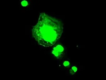 Anti-FGF1 antibody [4D2] used in Immunocytochemistry/ Immunofluorescence (ICC/IF). GTX84503