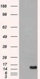 Anti-FGF1 antibody [4D2] used in Western Blot (WB). GTX84503