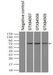 Anti-Mig-2 antibody [25A4] used in Immunoprecipitation (IP). GTX84505