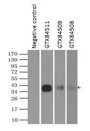 Anti-CD32a antibody [16D6] used in Immunoprecipitation (IP). GTX84509