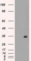 Anti-CD32a antibody [16D6] used in Western Blot (WB). GTX84509