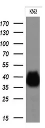 Anti-CD32a antibody [13D7] used in Western Blot (WB). GTX84511