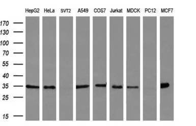 Anti-FAM84B antibody [2E7] used in Western Blot (WB). GTX84524