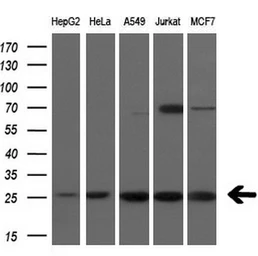 Anti-FADD antibody [1C11] used in Western Blot (WB). GTX84542