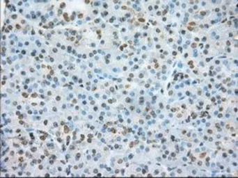 Anti-ERCC1 antibody [1B3] used in IHC (Paraffin sections) (IHC-P). GTX84546