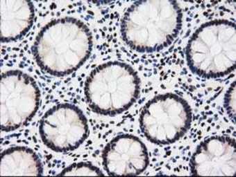 Anti-EPM2AIP1 antibody [1F11] used in IHC (Paraffin sections) (IHC-P). GTX84561