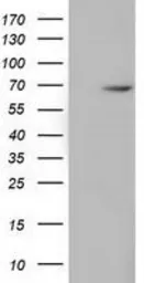 Anti-EPM2AIP1 antibody [5G8] used in Western Blot (WB). GTX84566