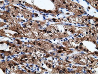 Anti-EPXH2 antibody [1H5] used in IHC (Paraffin sections) (IHC-P). GTX84569