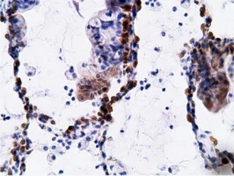 Anti-EPXH2 antibody [1H5] used in IHC (Paraffin sections) (IHC-P). GTX84569