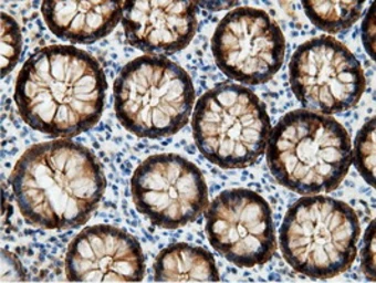 Anti-EPXH2 antibody [1H5] used in IHC (Paraffin sections) (IHC-P). GTX84569