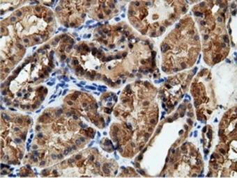 Anti-EPXH2 antibody [1H5] used in IHC (Paraffin sections) (IHC-P). GTX84569