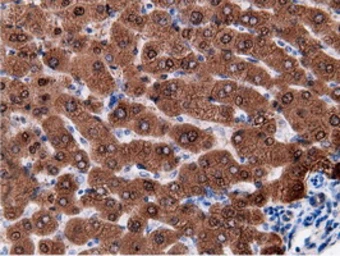 Anti-EPXH2 antibody [1H5] used in IHC (Paraffin sections) (IHC-P). GTX84569