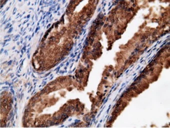 Anti-EPXH2 antibody [1H5] used in IHC (Paraffin sections) (IHC-P). GTX84569