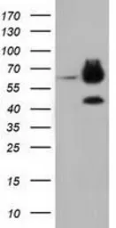 Anti-EPXH2 antibody [1H5] used in Western Blot (WB). GTX84569