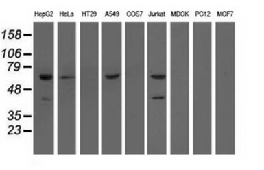 Anti-EPXH2 antibody [1A6] used in Western Blot (WB). GTX84570