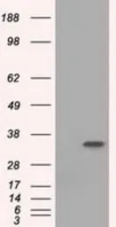 Anti-eIF2 alpha antibody [3H7] used in Western Blot (WB). GTX84578