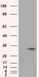 Anti-eIF2 alpha antibody [3H4] used in Western Blot (WB). GTX84579