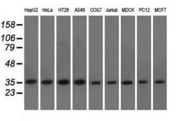 Anti-eIF2 alpha antibody [3H4] used in Western Blot (WB). GTX84579