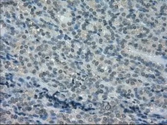 Anti-DHFR antibody [6G7] used in IHC (Paraffin sections) (IHC-P). GTX84617