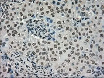 Anti-DHFR antibody [3A11] used in IHC (Paraffin sections) (IHC-P). GTX84618