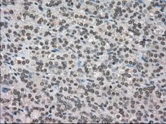 Anti-DHFR antibody [3A11] used in IHC (Paraffin sections) (IHC-P). GTX84618