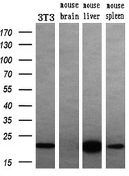 Anti-DHFR antibody [3A11] used in Western Blot (WB). GTX84618
