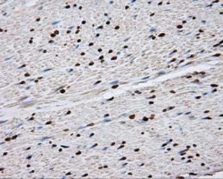 Anti-DAP Kinase 2 antibody [1C5] used in IHC (Paraffin sections) (IHC-P). GTX84631