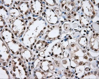 Anti-DAP Kinase 2 antibody [1C5] used in IHC (Paraffin sections) (IHC-P). GTX84631