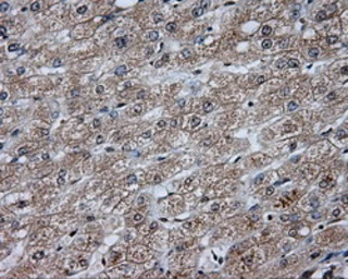 Anti-DAP Kinase 2 antibody [1C5] used in IHC (Paraffin sections) (IHC-P). GTX84631