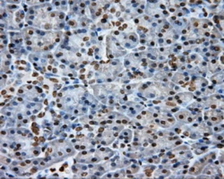 Anti-DAP Kinase 2 antibody [1C5] used in IHC (Paraffin sections) (IHC-P). GTX84631