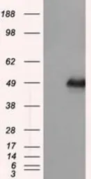 Anti-DAP Kinase 2 antibody [1C5] used in Western Blot (WB). GTX84631