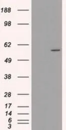 Anti-CYP2E1 antibody [9E6] used in Western Blot (WB). GTX84635