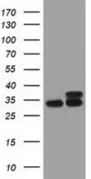 Anti-CYB5R3 antibody [2A10] used in Western Blot (WB). GTX84646