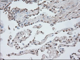 Anti-beta Catenin antibody [1F3] used in IHC (Paraffin sections) (IHC-P). GTX84650