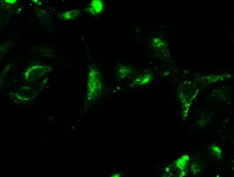 Anti-CTAG1B antibody [3C9] used in Immunocytochemistry/ Immunofluorescence (ICC/IF). GTX84652