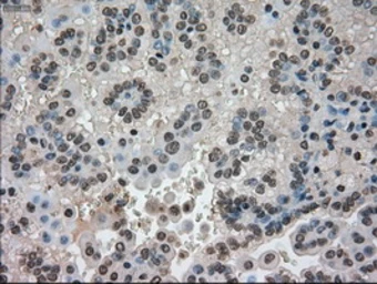 Anti-CTAG1B antibody [3C9] used in IHC (Paraffin sections) (IHC-P). GTX84652