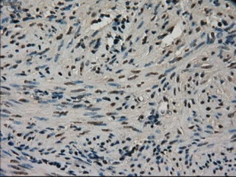 Anti-CTAG1B antibody [3C9] used in IHC (Paraffin sections) (IHC-P). GTX84652