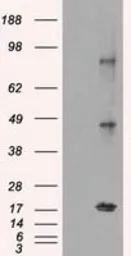 Anti-CTAG1B antibody [3C9] used in Western Blot (WB). GTX84652