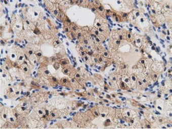 Anti-CRYM antibody [1G7] used in IHC (Paraffin sections) (IHC-P). GTX84654