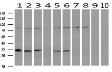Anti-CRYM antibody [1G7] used in Western Blot (WB). GTX84654