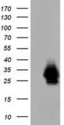 Anti-CRYM antibody [1G7] used in Western Blot (WB). GTX84654