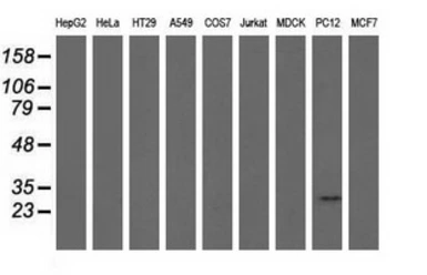 Anti-CRYM antibody [1G7] used in Western Blot (WB). GTX84654