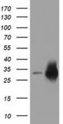 Anti-CRYM antibody [1B5] used in Western Blot (WB). GTX84655