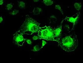 Anti-alpha B Crystallin antibody [6D11] used in Immunocytochemistry/ Immunofluorescence (ICC/IF). GTX84657