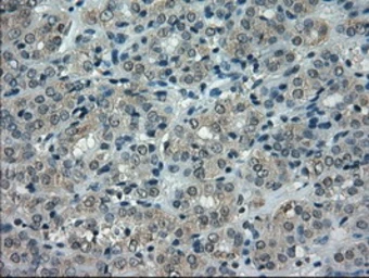 Anti-alpha B Crystallin antibody [6D11] used in IHC (Paraffin sections) (IHC-P). GTX84657