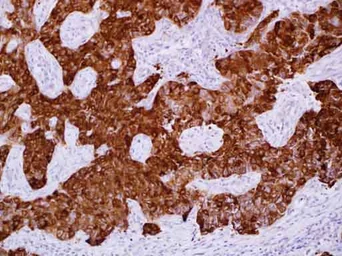Anti-alpha B Crystallin antibody [6D11] used in IHC (Paraffin sections) (IHC-P). GTX84657