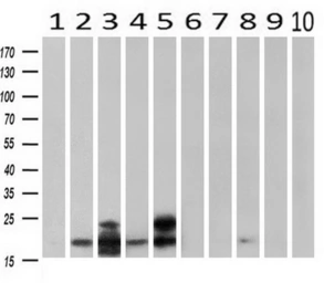 Anti-alpha B Crystallin antibody [6D11] used in Western Blot (WB). GTX84657
